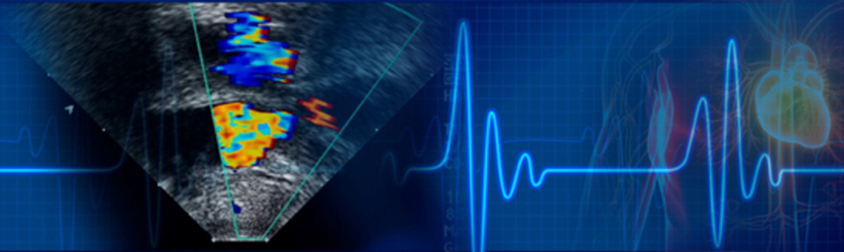 Echocardiography bekaa lebanon